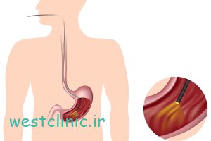 آندوسکوپی گوارشی