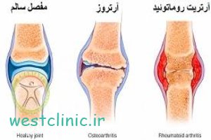 کلینیک روماتولوژی و روماتیسم درمانگاه امام علی ع در شهرک غرب و سعادت آباد