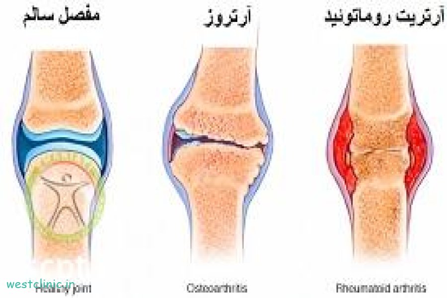 کلینیک روماتولوژی و روماتیسم درمانگاه امام علی ع در شهرک غرب و سعادت آباد