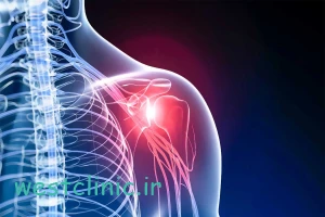 درمانگاه خیریه امام علی (ع) گام‌هایی مطمئن برای سلامت استخوان و مفاصل