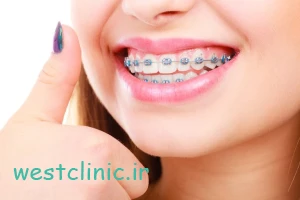 ارتودنسی راهی برای لبخندی زیبا