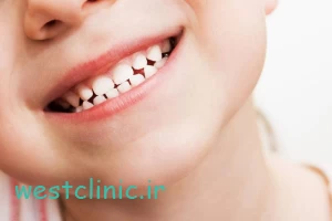 دندان شیری؛ چه زمانی باید بیفتد و چه زمانی مداخله لازم است؟