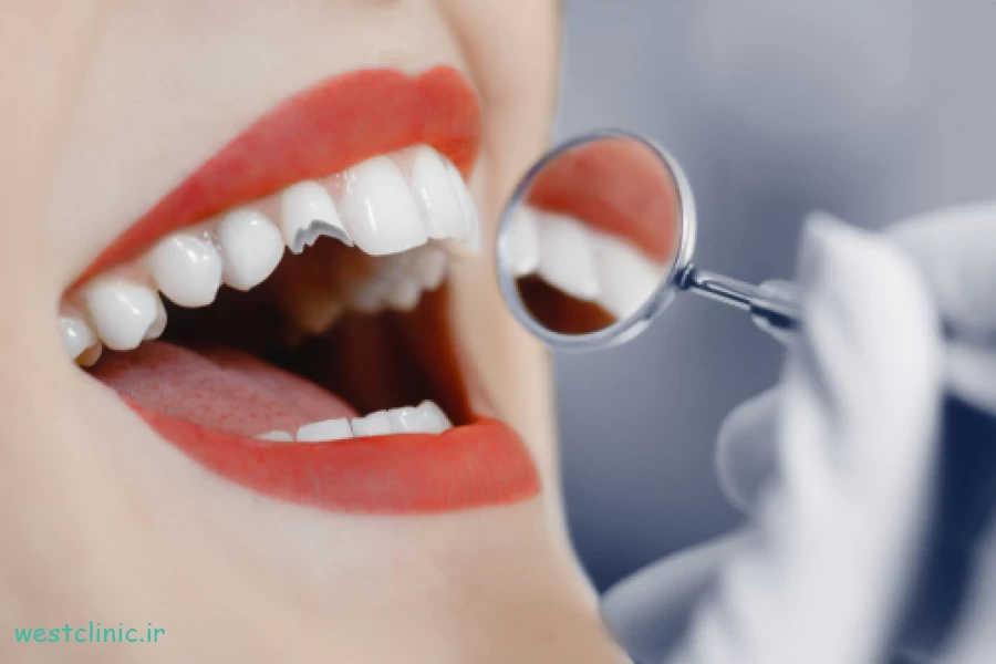 ترمیم دندان شکسته چه گزینه‌هایی دارید؟ از باندینگ تا روکش