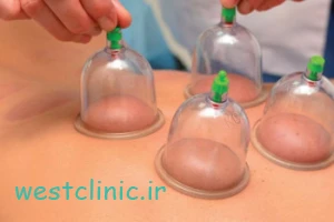 حجامت پایه علمی دارد؟