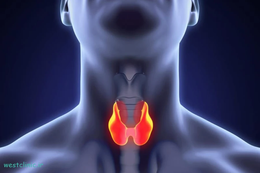 بایدها و نبایدهای رژیمی برای بیماران مبتلا به کم کاری تیروئید