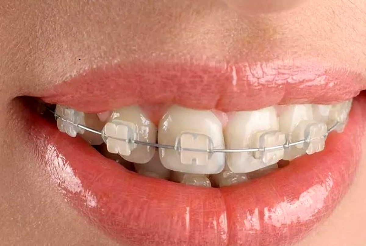 خدمات دندانپزشکی در درمانگاه خیریه امام علی ابن ابیطالب (ع)2