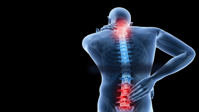 تفاوت دیسک کمر و آرتروز5