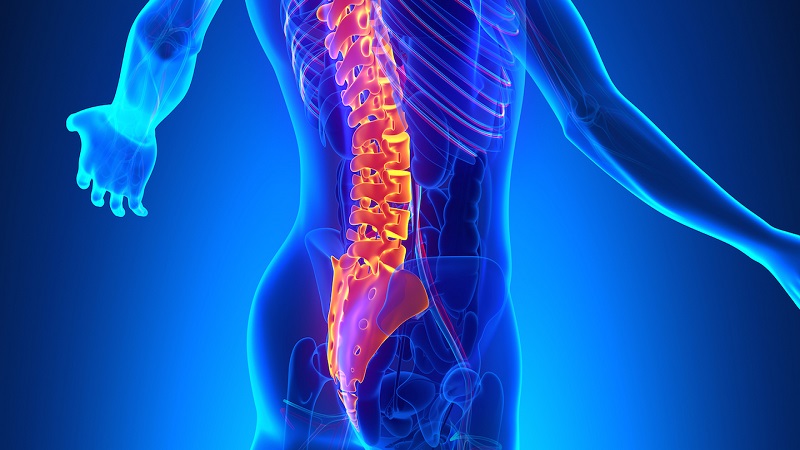 تفاوت دیسک کمر و آرتروز6