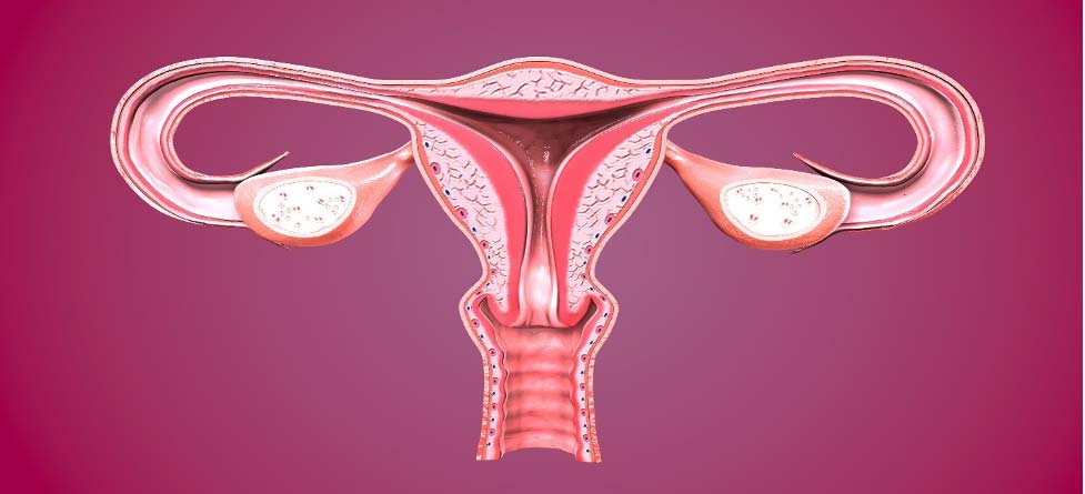 خونریزی غیرطبیعی رحم5