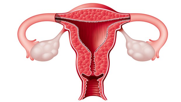 خونریزی غیرطبیعی رحم2